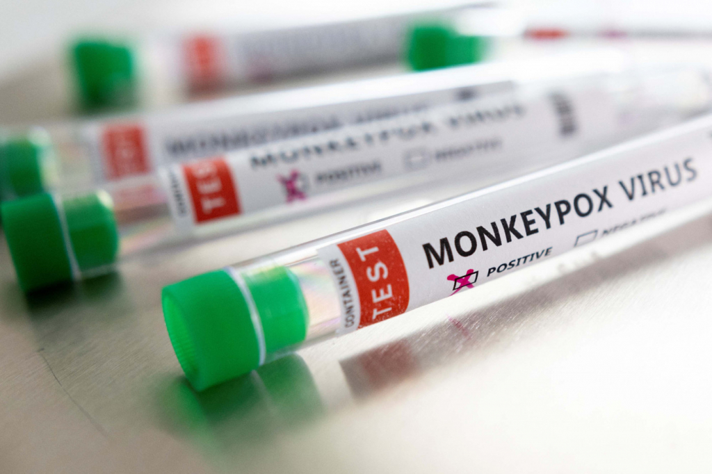 Monkeypox  - “Varíola dos Macacos”